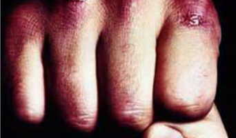 В центре Саратова чеченец одним ударом убил горожанина