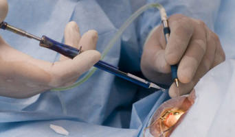 Оперативное лечение катаракты в Ульяновской области будет осуществляться бесплатно